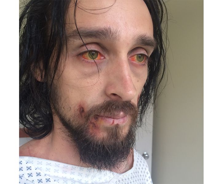 AIDS patient, WHEN WE RISE